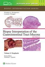 Biopsy Interpretation of the Gastrointestinal Tract Mucosa Volume 2: Neoplastic: Print + eBook with Multimedia