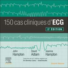 150 cas cliniques d'ECG