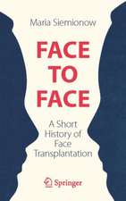 Face to Face: A Short History of Face Transplantation