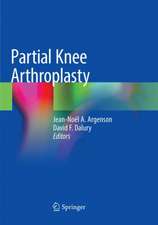 Partial Knee Arthroplasty