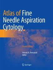 Atlas of Fine Needle Aspiration Cytology