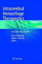 Intracerebral Hemorrhage Therapeutics: Concepts and Customs