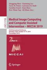 Medical Image Computing and Computer Assisted Intervention – MICCAI 2019: 22nd International Conference, Shenzhen, China, October 13–17, 2019, Proceedings, Part II