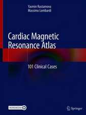 Cardiac Magnetic Resonance Atlas: 101 Clinical Cases