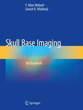 Skull Base Imaging: The Essentials