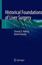 Historical Foundations of Liver Surgery