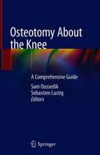 Osteotomy About the Knee: A Comprehensive Guide