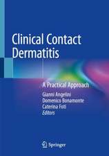 Clinical Contact Dermatitis: A Practical Approach