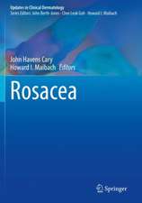 Rosacea