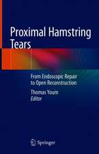 Proximal Hamstring Tears: From Endoscopic Repair to Open Reconstruction