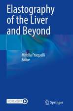 Elastography of the Liver and Beyond