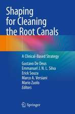 Shaping for Cleaning the Root Canals