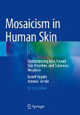 Mosaicism in Human Skin: Understanding Nevi, Nevoid Skin Disorders, and Cutaneous Neoplasia