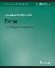 Tremor: From Pathogenesis to Treatment