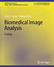 Biomedical Image Analysis: Tracking