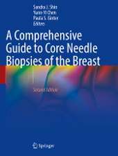 A Comprehensive Guide to Core Needle Biopsies of the Breast