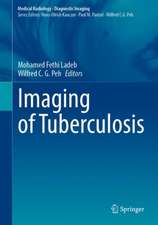 Imaging of Tuberculosis