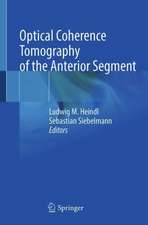 Optical Coherence Tomography of the Anterior Segment