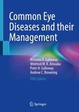 Common Eye Diseases and their Management