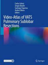 Video-Atlas of VATS Pulmonary Sublobar Resections