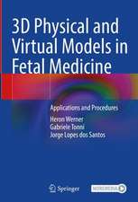 3D Physical and Virtual Models in Fetal Medicine: Applications and Procedures