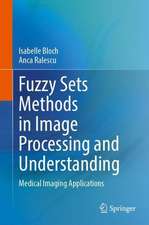 Fuzzy Sets Methods in Image Processing and Understanding: Medical Imaging Applications