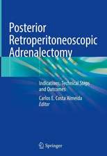 Posterior Retroperitoneoscopic Adrenalectomy: Indications, Technical Steps and Outcomes