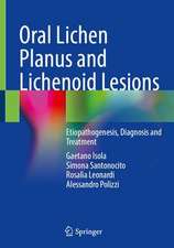 Oral Lichen Planus and Lichenoid Lesions