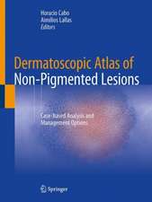 Dermatoscopic Atlas of Non-Pigmented Lesions: Case-based Analysis and Management Options