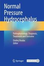Normal Pressure Hydrocephalus