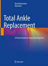 Total Ankle Replacement: A Practical Guide to Surgical Management