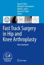 Fast Track Surgery in Hip and Knee Arthroplasty: New Standards 