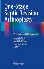 One-Stage Septic Revision Arthroplasty: Principles and Management