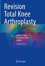 Revision Total Knee Arthroplasty