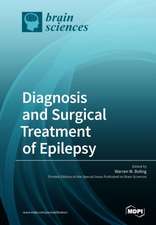 Diagnosis and Surgical Treatment of Epilepsy