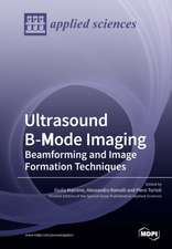 Ultrasound B-Mode Imaging