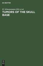 Tumors of the skull base: Extra- and intracranial surgery of skull base tumors