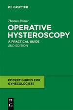 Operative Hysteroscopy: A Practical Guide