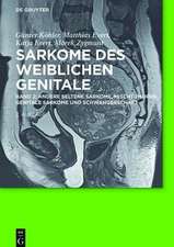 Sarkome des weiblichen Genitale