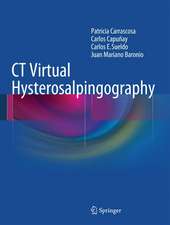 CT Virtual Hysterosalpingography