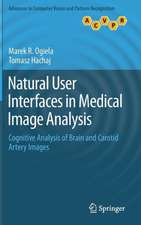 Natural User Interfaces in Medical Image Analysis: Cognitive Analysis of Brain and Carotid Artery Images