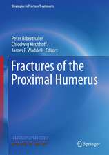 Fractures of the Proximal Humerus