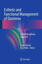 Esthetic and Functional Management of Diastema