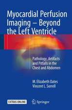 Myocardial Perfusion Imaging - Beyond the Left Ventricle: Pathology, Artifacts and Pitfalls in the Chest and Abdomen