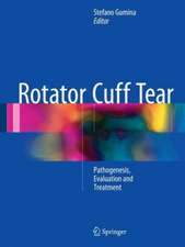 Rotator Cuff Tear: Pathogenesis, Evaluation and Treatment