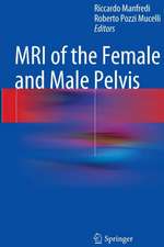 MRI of the Female and Male Pelvis