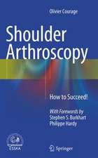 Shoulder Arthroscopy: How to Succeed!