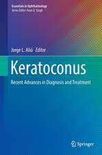 Keratoconus: Recent Advances in Diagnosis and Treatment