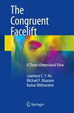 The Congruent Facelift: A Three-dimensional View