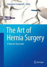 The Art of Hernia Surgery: A Step-by-Step Guide